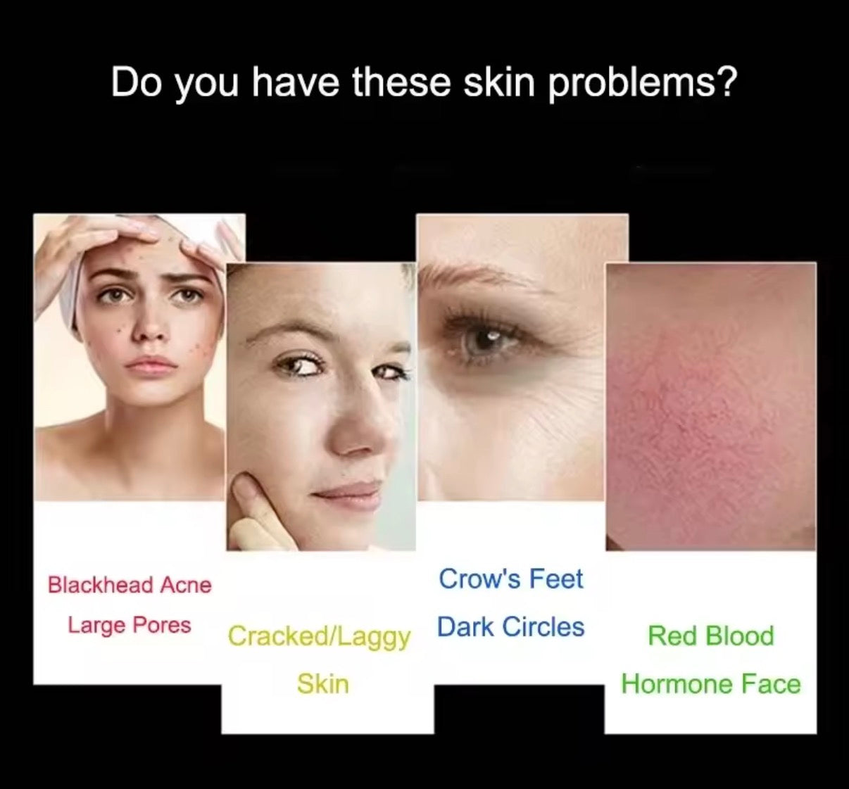 7-Color LED Face & Neck Therapy Set – Photon Light Mask with Hot & Cold Spray for Anti-Aging & Acne Care